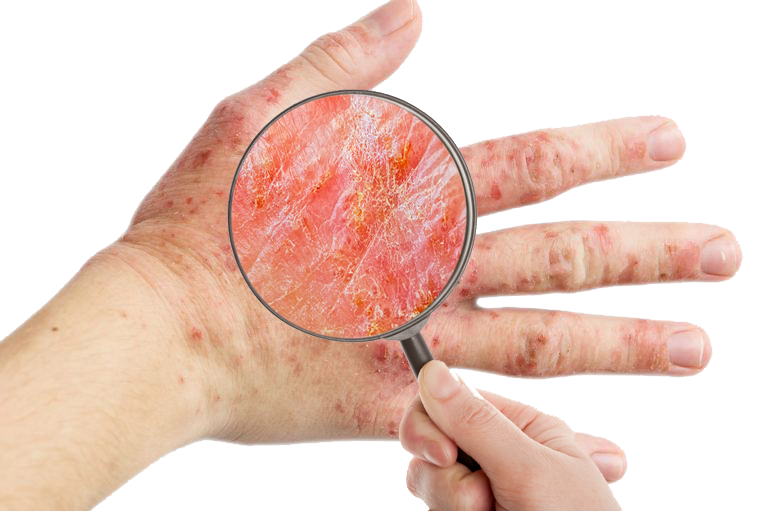 Gloves Kids and Adults Hand Eczema Bamboo Cotton Gloves